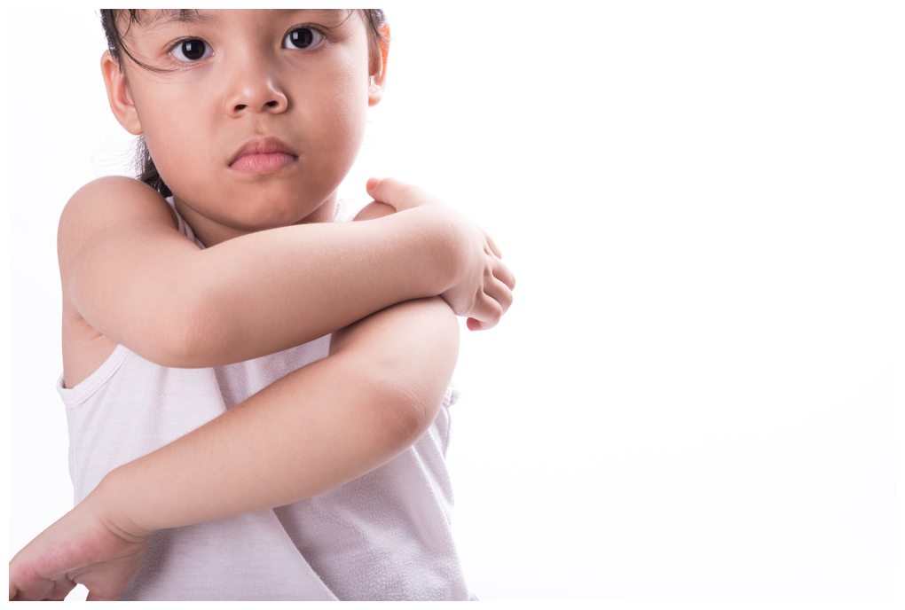 Young asian girl with clear skin scratching an it on her shoulder. ringworm is typically localised where as eczema is usually widespread